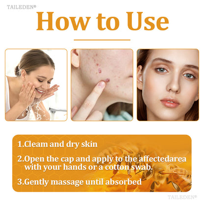 👨‍⚕️ TAILEDEN® BeeDerm RX Cream, Painless, Targeted Treatment for Warts, Skin Tags, Skin Lesions, Infections, and Scars