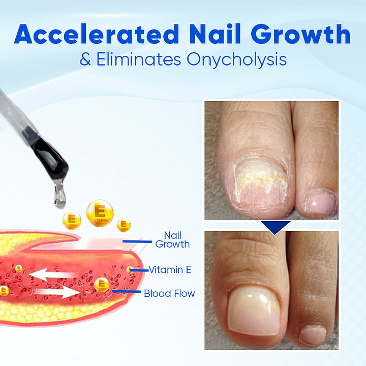 OnyxNourish Nail Growth and Repair Serum