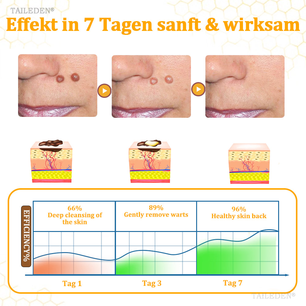 👨‍⚕️ TAILEDEN® BeeDerm RX Cream, Painless, Targeted Treatment for Warts, Skin Tags, Skin Lesions, Infections, and Scars