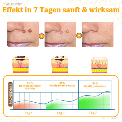 👨‍⚕️ TAILEDEN® BeeDerm RX Cream, Painless, Targeted Treatment for Warts, Skin Tags, Skin Lesions, Infections, and Scars