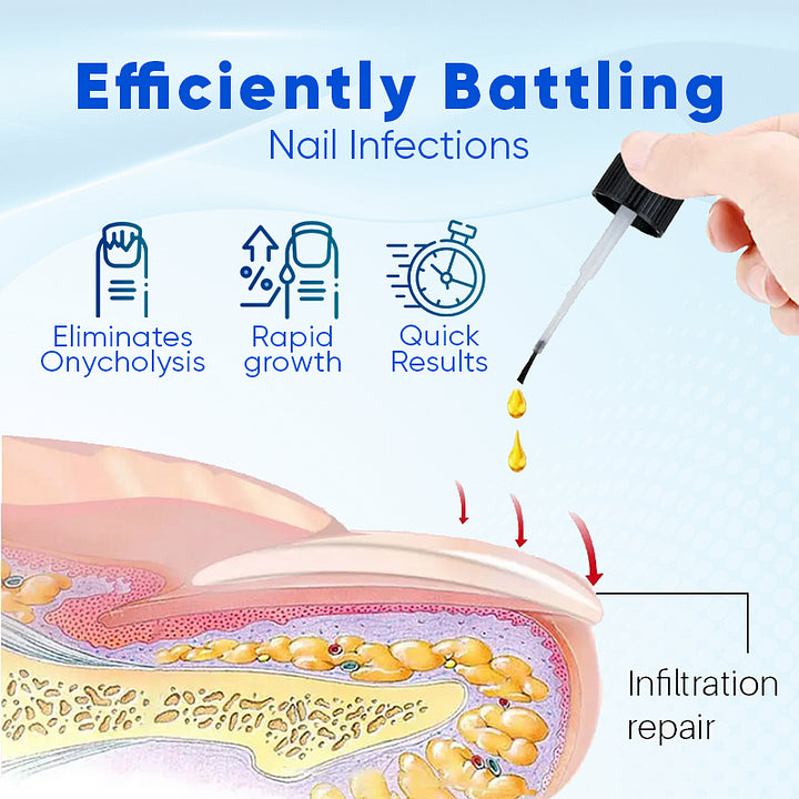 OnyxNourish Nail Growth and Repair Serum