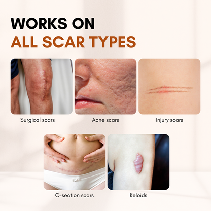 Clinclii® ClearFlaw Silicone Scar Solution Stick